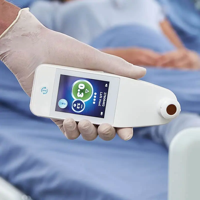 Close-up of the Provizio SEM Scanner device showing a detailed digital display used during patient assessments.