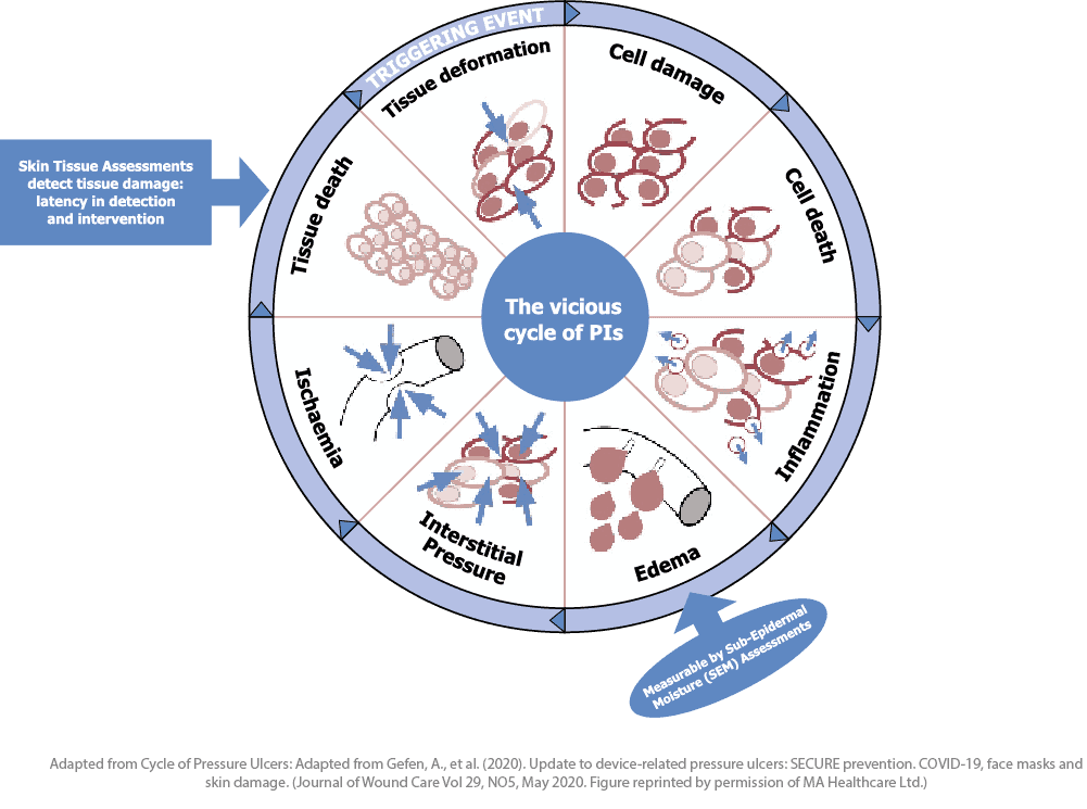 Diagram illustrating the vicious cycle of pressure injuries (PIs), depicting stages like tissue deformation, cell damage, cell death, inflammation, edema, interstitial pressure, and ischemia. Arrows indicate progression and interventions like skin tissue assessments and measurable sub-epidermal moisture assessments to detect and prevent tissue damage.
