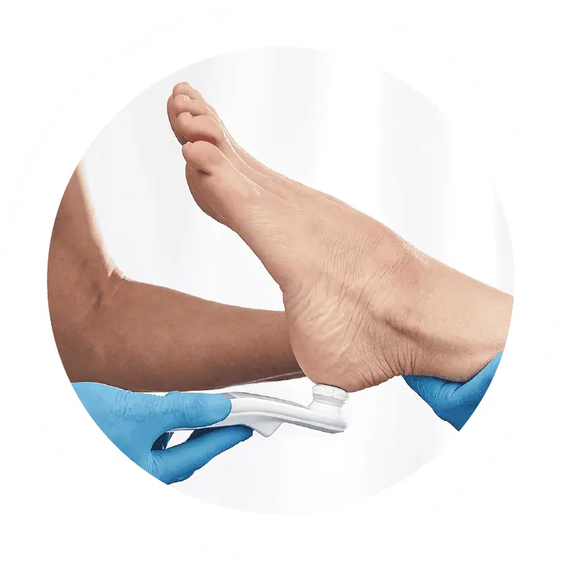 Healthcare professional using a handheld SEM Scanner device on the heel of a patient's foot to assess the risk of pressure injuries, demonstrating the practical application of the technology in a clinical setting.